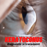 keratoconus -stadii simptome tratament