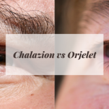 Chalazion (Salazion) sau Orjelet
